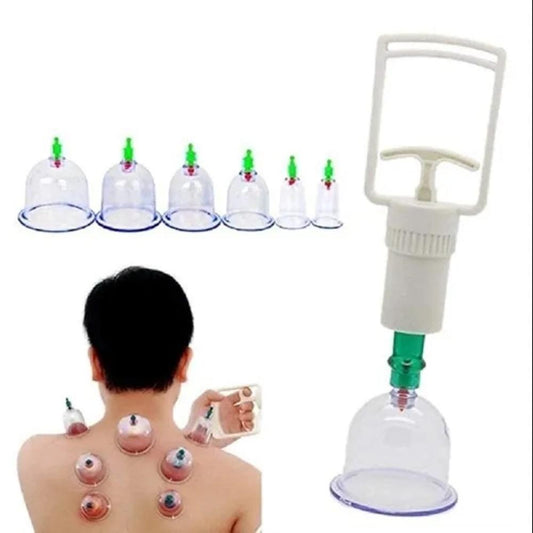 Ventosaterapia Kit 12 Ventosas Copos Massoterapia Chines Acupuntura Terapia Sucção Estética